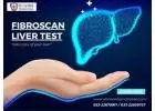 Liver Wellness Unveiled: Olivine International's Advanced FibroScan Test