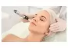 Best Microneedling Treatment in River Bend