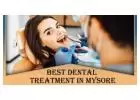 Best Dental Treatment in Mysore