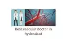 best vascular doctor in hyderabad